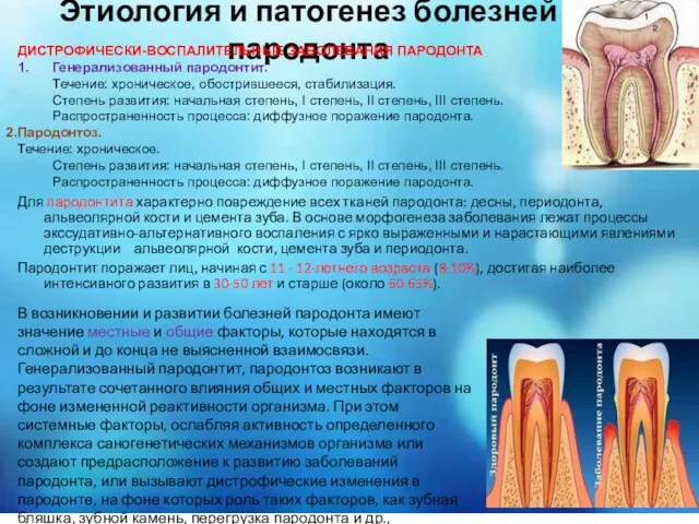 Для пародонтита характерно повреждение всех тканей пародонта: десны, периодонта, альвеолярной кости и