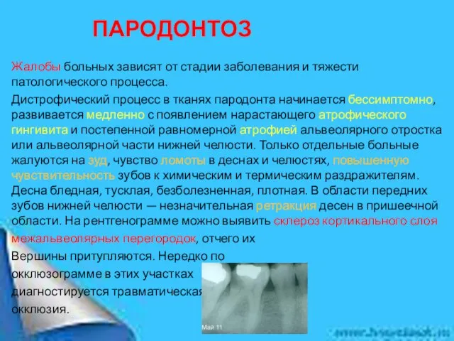 ПАРОДОНТОЗ Жалобы больных зависят от стадии заболевания и тяжести патологического процесса. Дистрофический