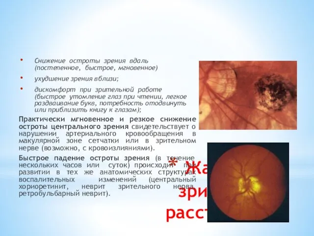 Жалобы на зрительные расстройства Снижение остроты зрения вдаль (постепенное, быстрое, мгновенное) ухудшение