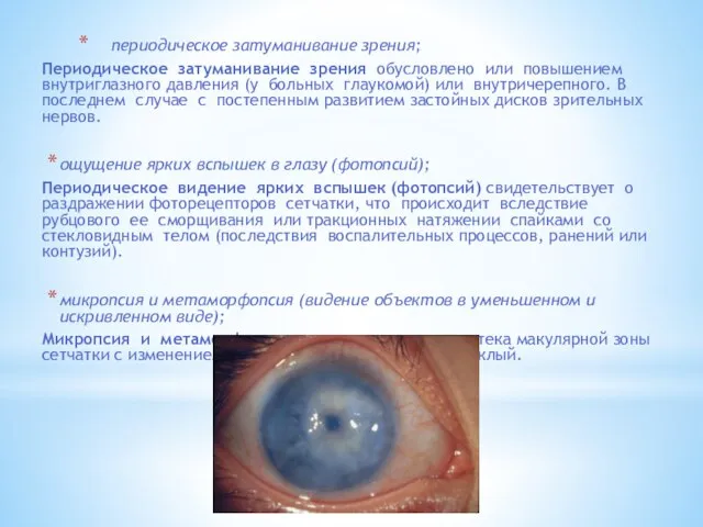 периодическое затуманивание зрения; Периодическое затуманивание зрения обусловлено или повышением внутриглазного давления (у