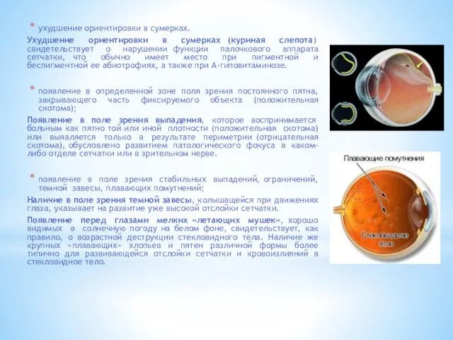 ухудшение ориентировки в сумерках. Ухудшение ориентировки в сумерках (куриная слепота) свидетельствует о