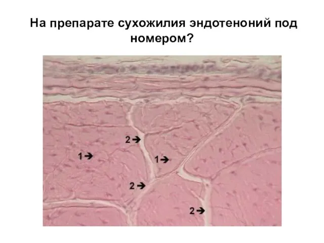 На препарате сухожилия эндотеноний под номером?