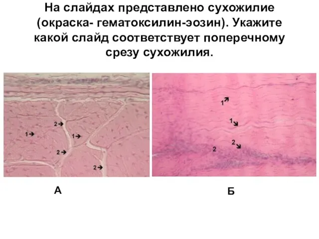 На слайдах представлено сухожилие (окраска- гематоксилин-эозин). Укажите какой слайд соответствует поперечному срезу сухожилия. А Б