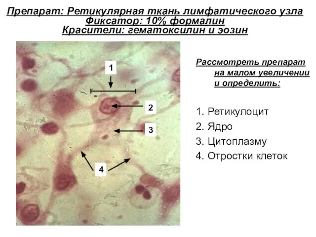 Препарат: Ретикулярная ткань лимфатического узла Фиксатор: 10% формалин Красители: гематоксилин и эозин