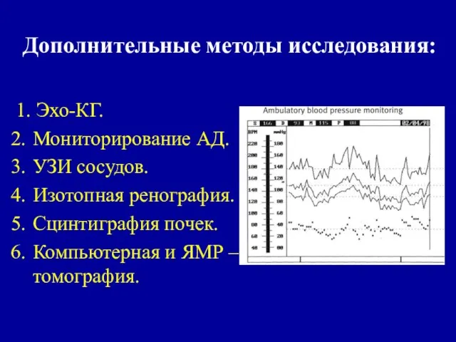 Дополнительные методы исследования: 1. Эхо-КГ. Мониторирование АД. УЗИ сосудов. Изотопная ренография. Сцинтиграфия