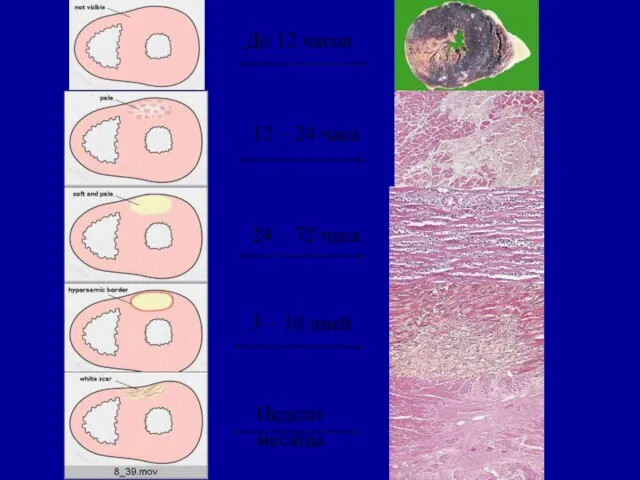 До 12 часов 12 – 24 часа 24 – 72 часа 3