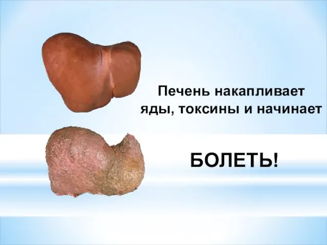 Печень накапливает яды, токсины и начинает БОЛЕТЬ!