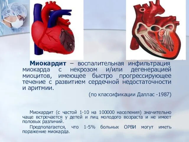 Миокардит – воспалительная инфильтрация миокарда с некрозом и/или дегенерацией миоцитов, имеющее быстро