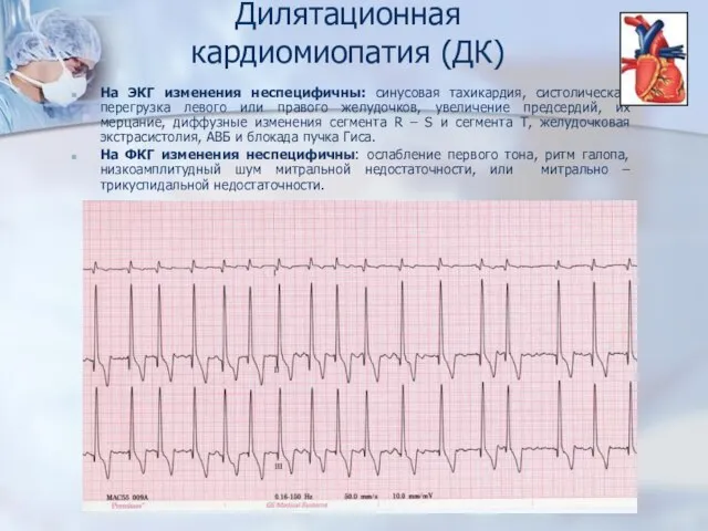 На ЭКГ изменения неспецифичны: синусовая тахикардия, систолическая перегрузка левого или правого желудочков,