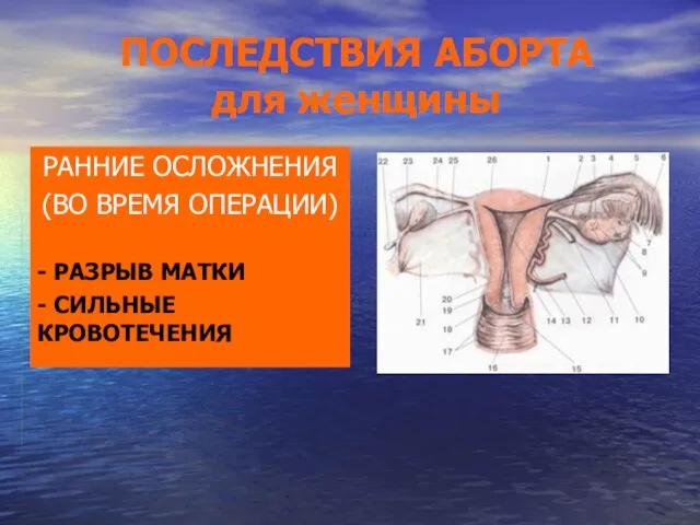 ПОСЛЕДСТВИЯ АБОРТА для женщины РАННИЕ ОСЛОЖНЕНИЯ (ВО ВРЕМЯ ОПЕРАЦИИ) - РАЗРЫВ МАТКИ - СИЛЬНЫЕ КРОВОТЕЧЕНИЯ