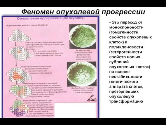 Феномен опухолевой прогрессии - Это переход от моноклоновости (гомогенности свойств опухолевых клеток)