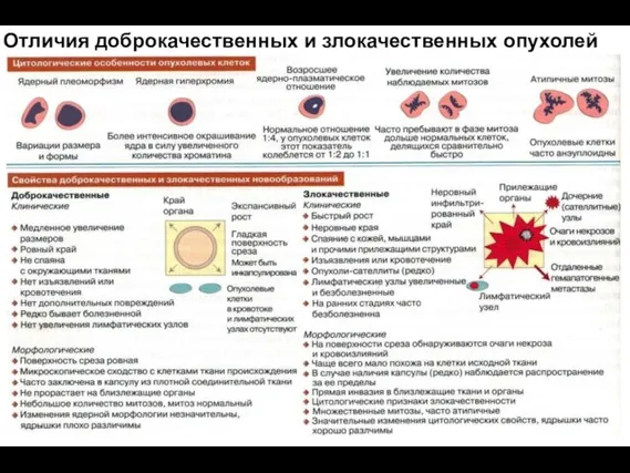 Отличия доброкачественных и злокачественных опухолей