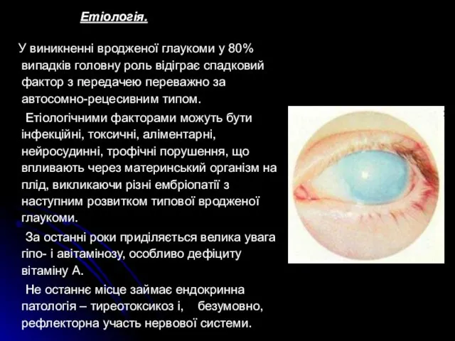 Етіологія. У виникненні вродженої глаукоми у 80% випадків головну роль відіграє спадковий