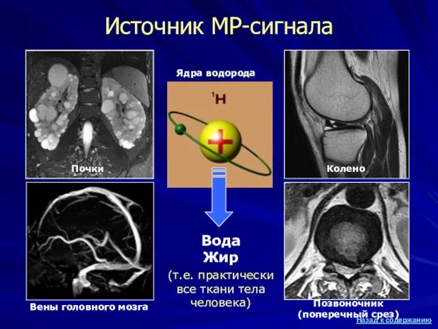 Источник МР-сигнала Вода Жир (т.е. практически все ткани тела человека) Ядра водорода