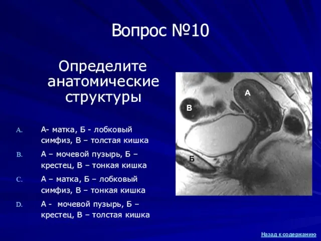 Вопрос №10 Определите анатомические структуры А- матка, Б - лобковый симфиз, В