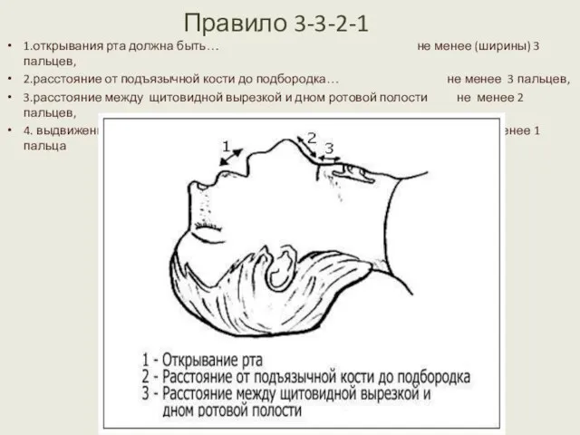 Правило 3-3-2-1 1.открывания рта должна быть… не менее (ширины) 3 пальцев, 2.расстояние