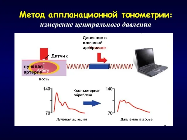 Метод аппланационной тонометрии: измерение центрального давления