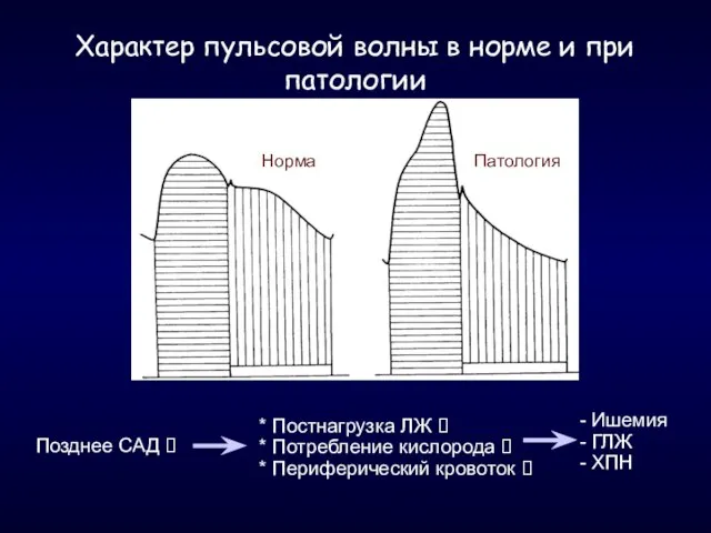 Характер пульсовой волны в норме и при патологии Норма Патология Позднее САД