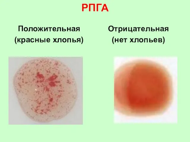 РПГА Положительная (красные хлопья) Отрицательная (нет хлопьев)