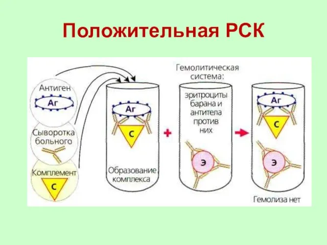 Положительная РСК