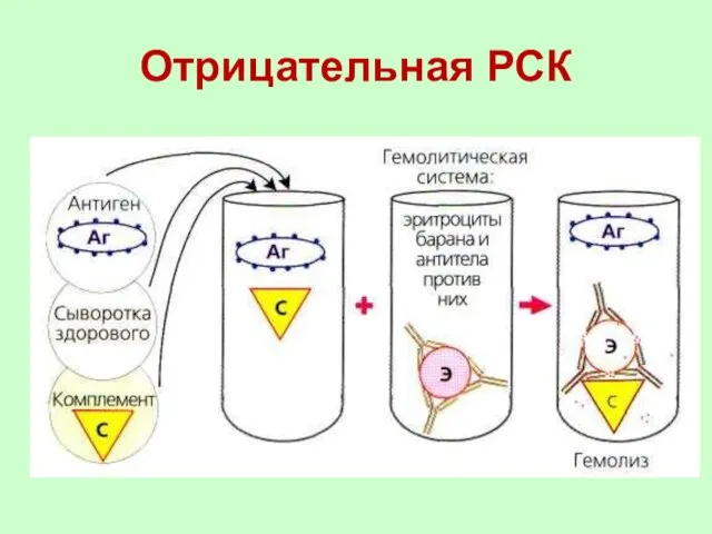 Отрицательная РСК