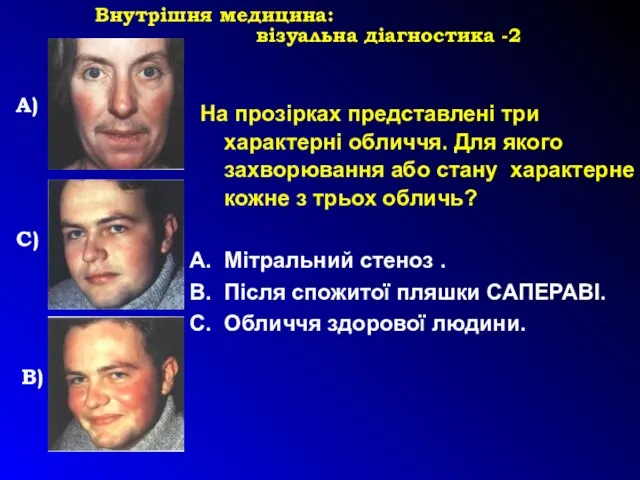 Внутрішня медицина: візуальна діагностика -2 А) С) В) На прозірках представлені три