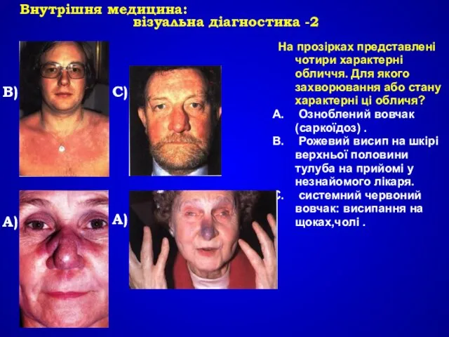 Внутрішня медицина: візуальна діагностика -2 В) А) С) На прозірках представлені чотири