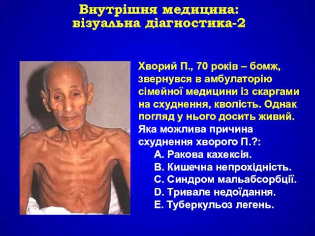 Хворий П., 70 років – бомж, звернувся в амбулаторію сімейної медицини із