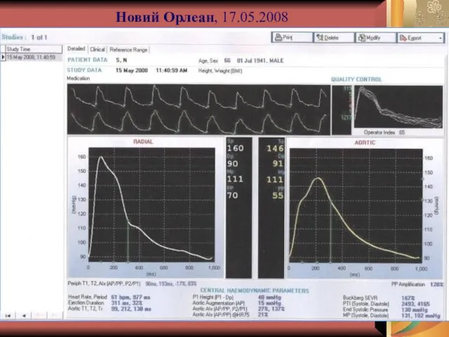 Новий Орлеан, 17.05.2008