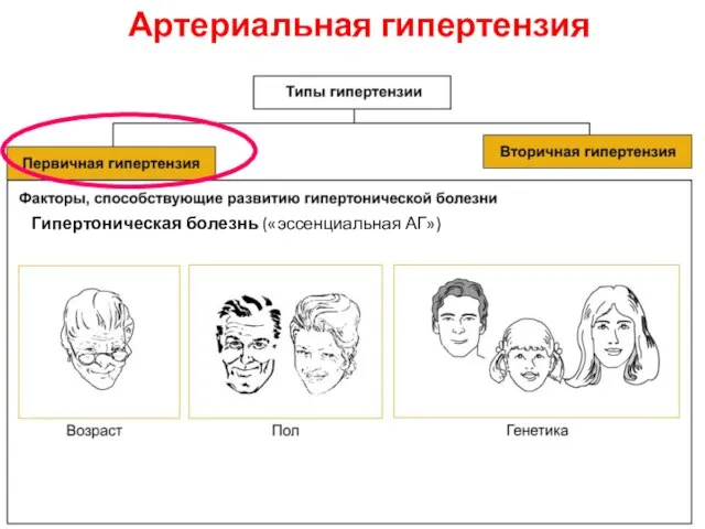 Артериальная гипертензия Гипертоническая болезнь («эссенциальная АГ»)