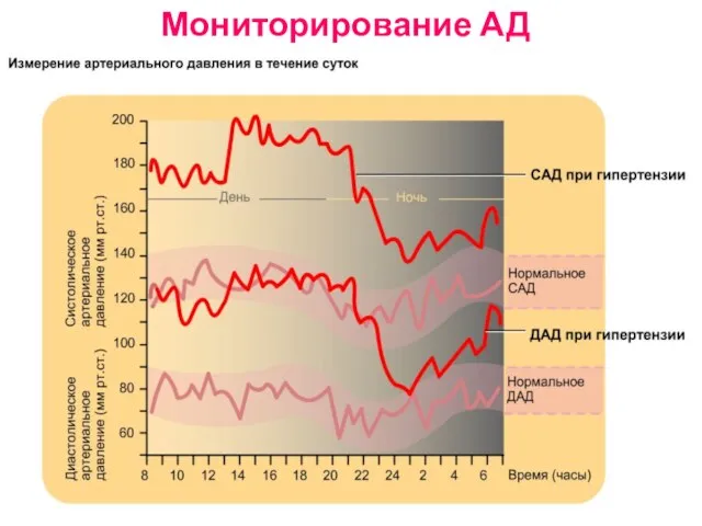 Мониторирование АД