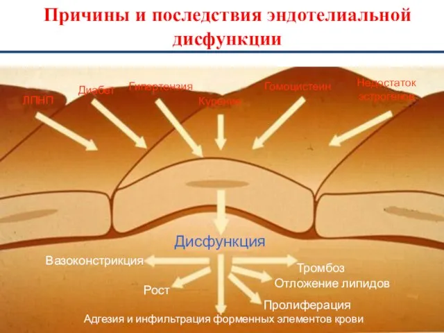 Причины и последствия эндотелиальной дисфункции Дисфункция Тромбоз Отложение липидов Пролиферация Адгезия и