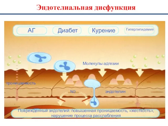 Эндотелиальная дисфункция АГ Диабет Курение Гиперлипидемия Молекулы адгезии NO эндотелин проницаемость Поврежденный