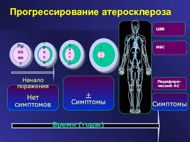 Нет симптомов + Симптомы Прогрессирование атеросклероза Просвет Просвет Просвет Просвет Время (годы)