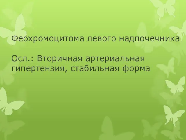 Феохромоцитома левого надпочечника Осл.: Вторичная артериальная гипертензия, стабильная форма