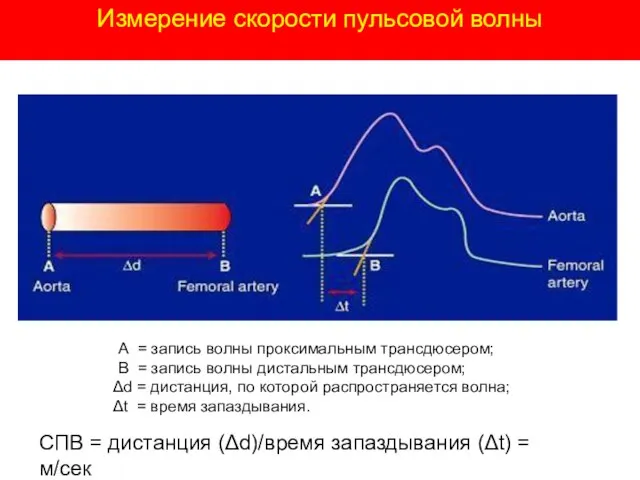 А = запись волны проксимальным трансдюсером; В = запись волны дистальным трансдюсером;