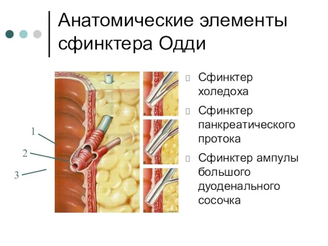 Анатомические элементы сфинктера Одди Сфинктер холедоха Сфинктер панкреатического протока Сфинктер ампулы большого