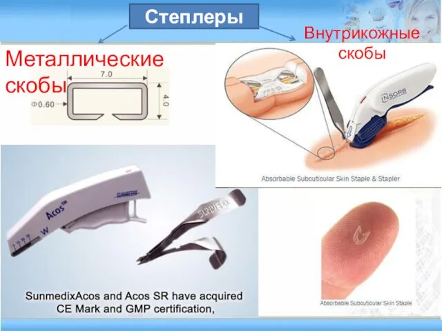 Степлеры Металлические скобы Внутрикожные скобы