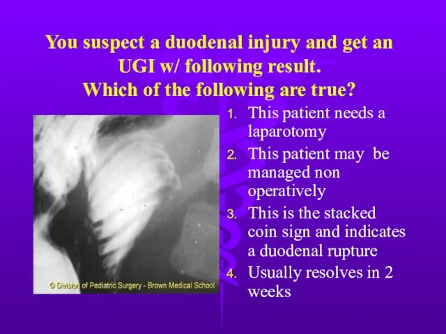 You suspect a duodenal injury and get an UGI w/ following result.