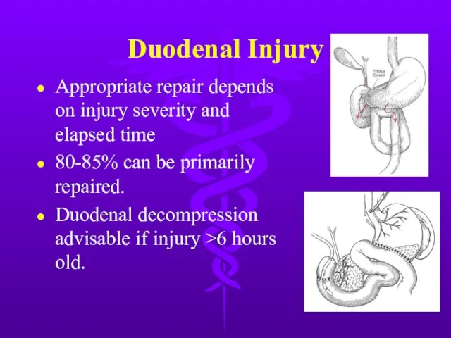 Duodenal Injury Appropriate repair depends on injury severity and elapsed time 80-85%