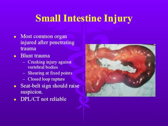 Small Intestine Injury Most common organ injured after penetrating trauma Blunt trauma