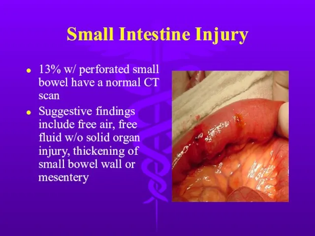 Small Intestine Injury 13% w/ perforated small bowel have a normal CT