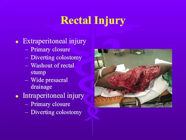 Rectal Injury Extraperitoneal injury Primary closure Diverting colostomy Washout of rectal stump