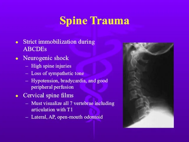 Spine Trauma Strict immobilization during ABCDEs Neurogenic shock High spine injuries Loss