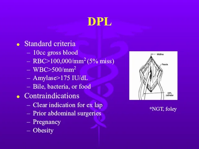 DPL Standard criteria 10cc gross blood RBC>100,000/mm2 (5% miss) WBC>500/mm2 Amylase>175 IU/dL