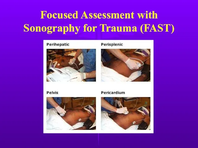 Focused Assessment with Sonography for Trauma (FAST)