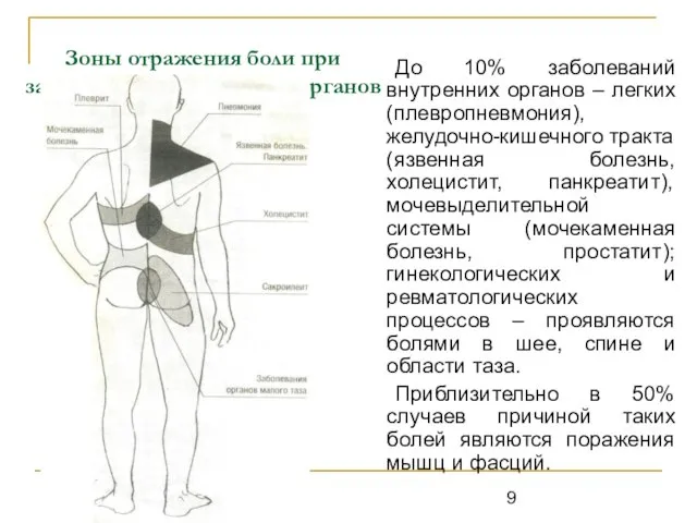 Зоны отражения боли при заболеваниях внутренних органов До 10% заболеваний внутренних органов