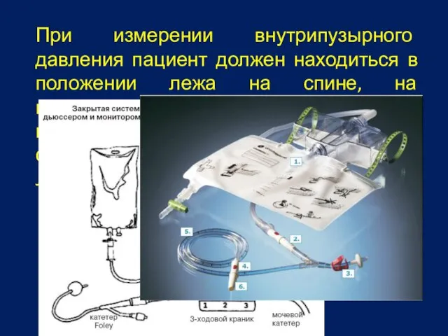 При измерении внутрипузырного давления пациент должен находиться в положении лежа на спине,