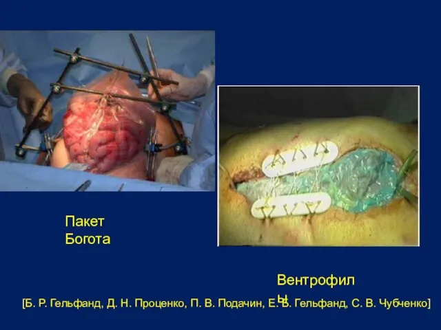 Пакет Богота Вентрофилы [Б. Р. Гельфанд, Д. Н. Проценко, П. В. Подачин,