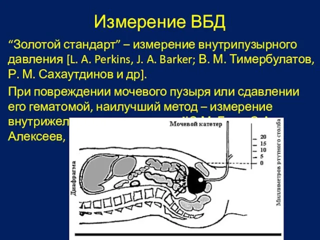 Измерение ВБД “Золотой стандарт” – измерение внутрипузырного давления [L. A. Perkins, J.